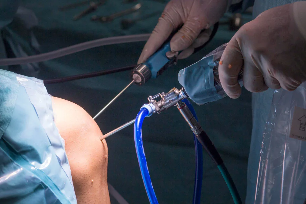 Cirugía mínimamente invasiva