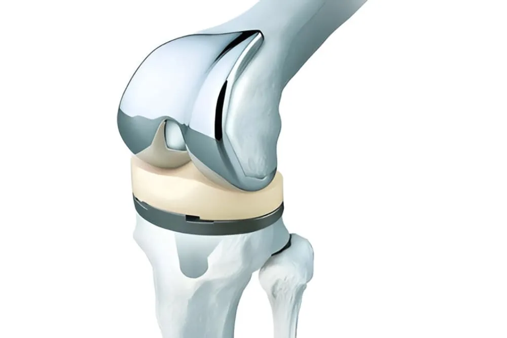 Prótesis de rodilla, cadera y hombro